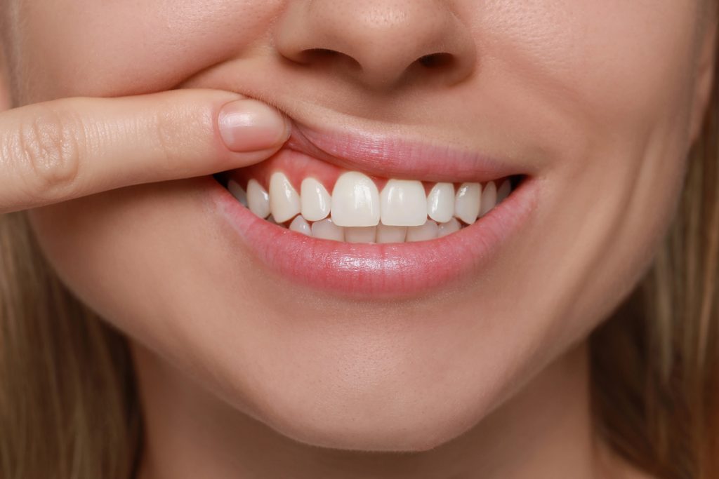 What Is Periodontal (Gum) Disease? Causes, Types & Symptoms 1 A Woman showing her healthy gums.