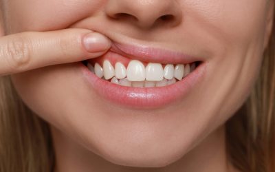 Blog 4 What Is Periodontal (Gum) Disease? Causes, Types & Symptoms